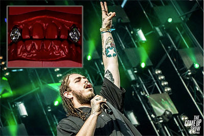 Post Malone Recounts How He Nearly Lost a $600K Diamond Tooth Down a Drain